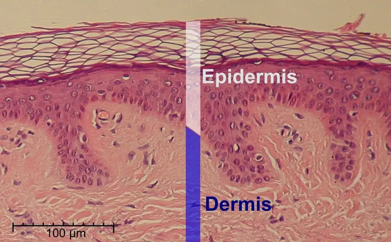 skin section dermis and epidermis