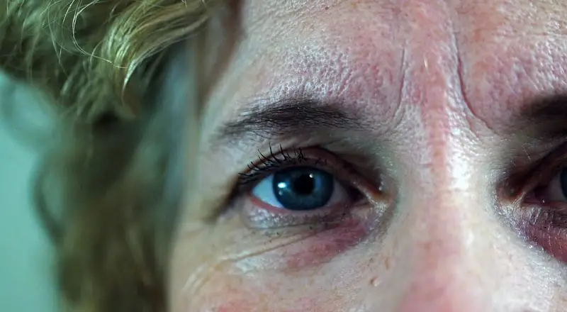 wrinkles fixable with skin rejuvenation