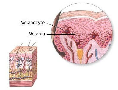 hyperpigmentation treatment - melanin production