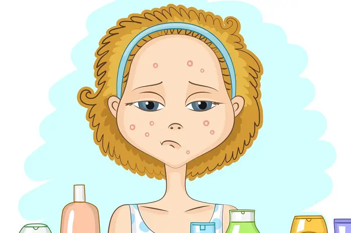 How to Get Rid of a Pimple Overnight