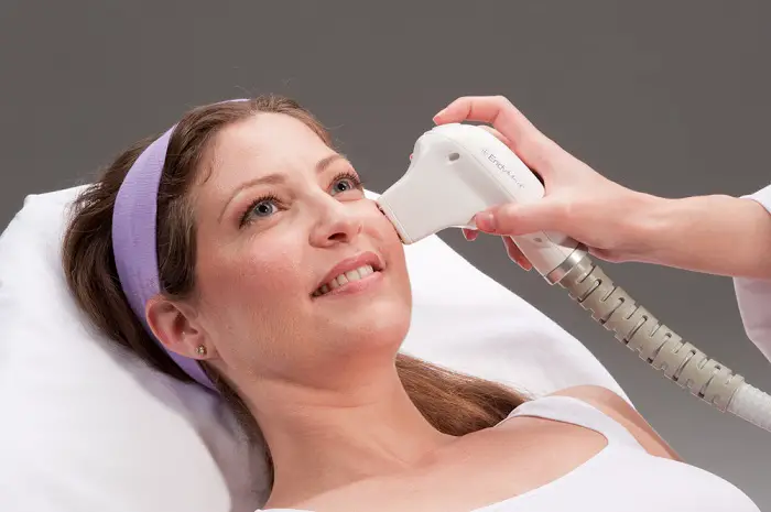 woman getting a laser treatment