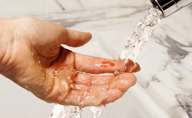 rinse wound with water